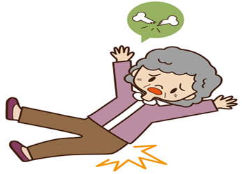 Accidental falls in elderly people