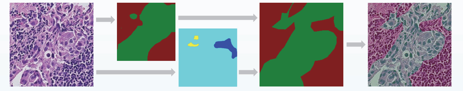 Slide screening
